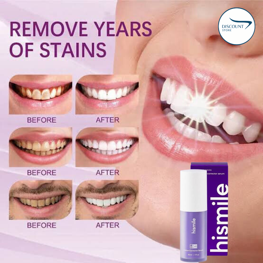 V34 Teeth Whitening Serum - (IMPORTED)
