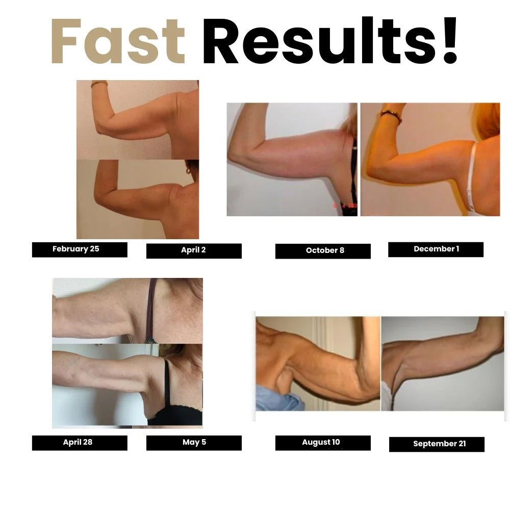 Arms Shaper Sleeves (Say Goodbye to Arm Jiggle)
